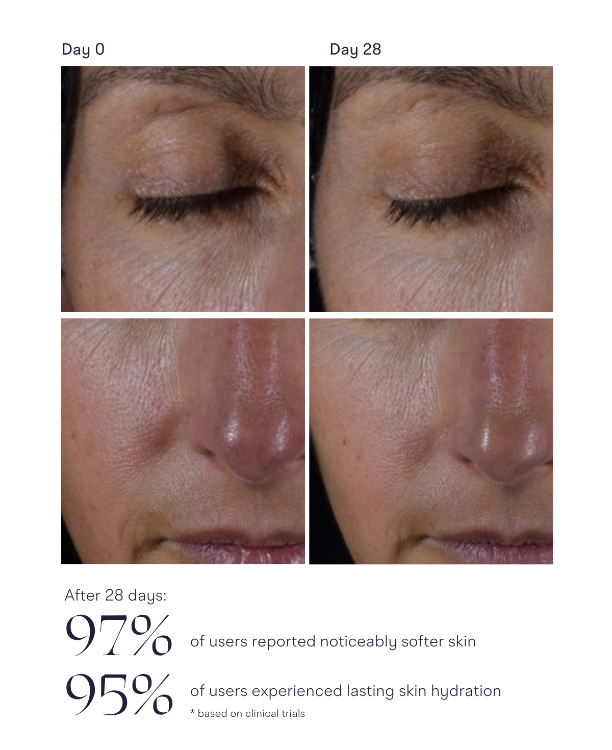 Active NAD+ Essential Cream- Advanced Skin Tightening & Anti-Wrinkle Formula