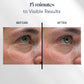 Before and after using Intuisse Active NAD+ Collagen Eye Masks for 15 minutes, showing visible under-eye results.