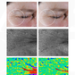 Before and after photos of the under-eye area after 28 days using Intuisse Active NAD+ Eye Serum
