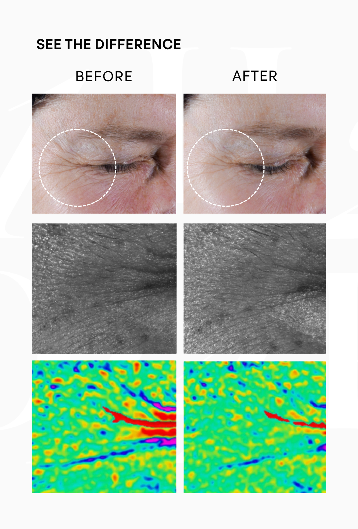 Before and after photos of the under-eye area after 28 days using Intuisse Active NAD+ Eye Serum