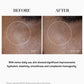 Before and after 28 days of twice-daily use of Intuisse Active NAD+ Peptide Essential Cream