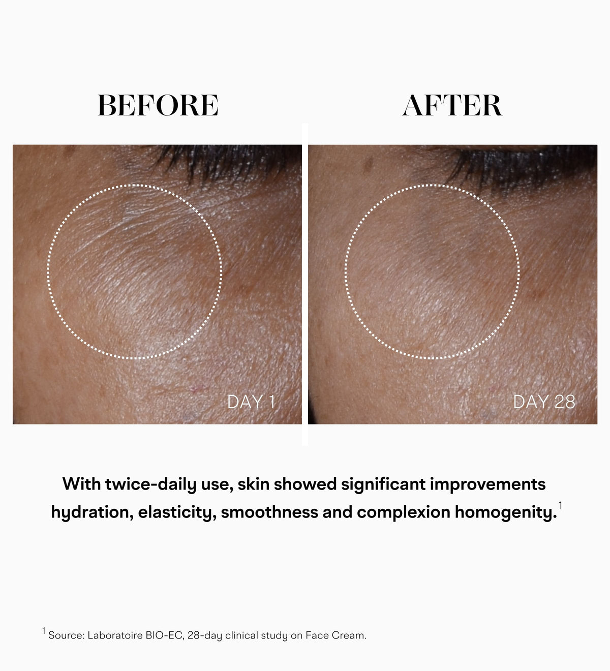 Before and after 28 days of twice-daily use of Intuisse Active NAD+ Peptide Essential Cream