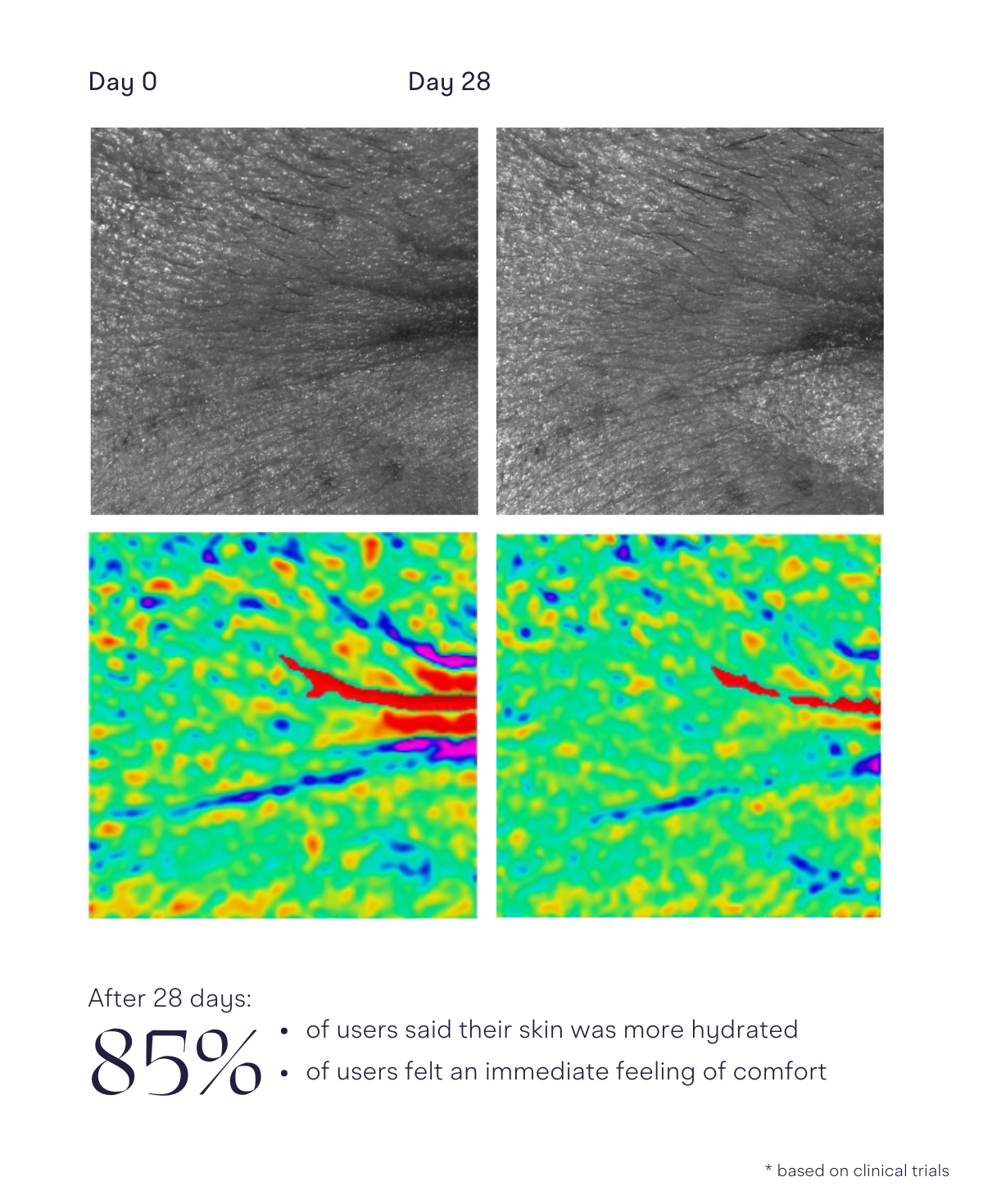 Before and after under eye skin analysis, 28 days with Intuisse Active NAD+ Eye Serum